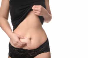 Woman holding mild loose skin on stomach, considering a tummy tuck